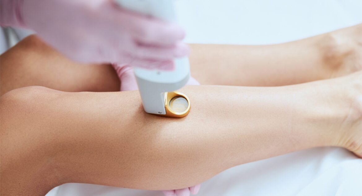 RR-Blog-LaserHairRemoval-01-scaled.jpg